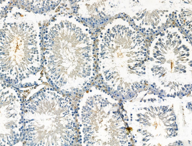 XPO5 Antibody in Immunohistochemistry (Paraffin) (IHC (P))