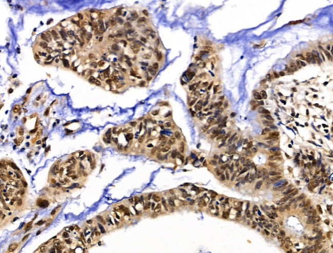 XPO5 Antibody in Immunohistochemistry (Paraffin) (IHC (P))