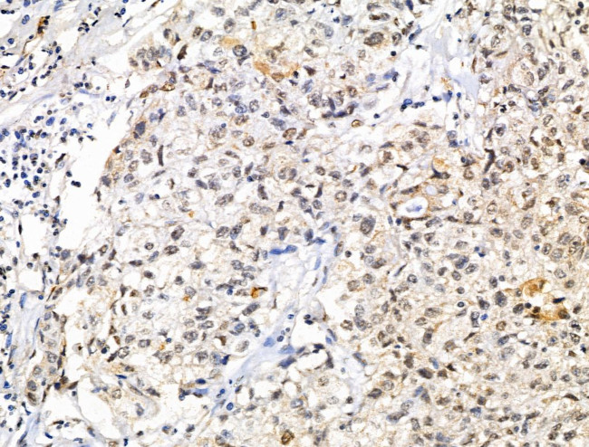 XPO5 Antibody in Immunohistochemistry (Paraffin) (IHC (P))