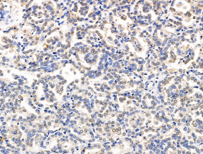 XPO5 Antibody in Immunohistochemistry (Paraffin) (IHC (P))