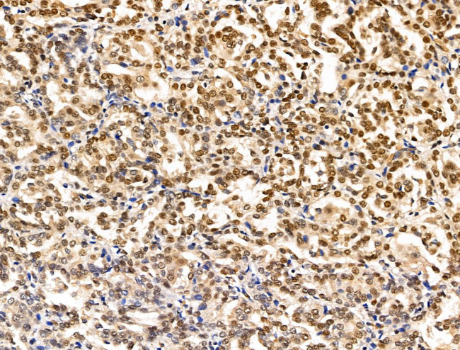 XPO5 Antibody in Immunohistochemistry (Paraffin) (IHC (P))