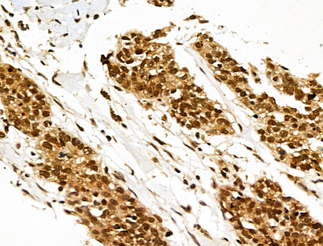 XPO5 Antibody in Immunohistochemistry (Paraffin) (IHC (P))