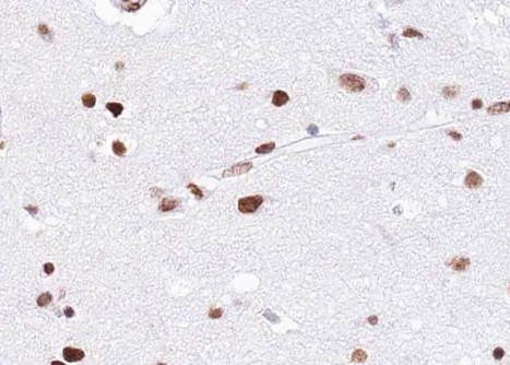 EZH1 Antibody in Immunohistochemistry (Paraffin) (IHC (P))