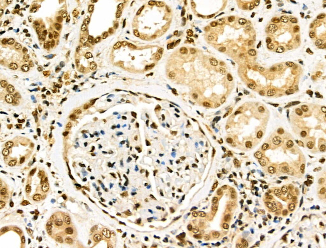 EZH1 Antibody in Immunohistochemistry (Paraffin) (IHC (P))