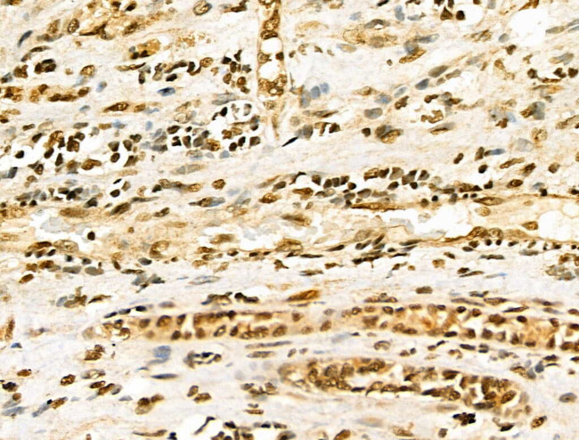 EZH1 Antibody in Immunohistochemistry (Paraffin) (IHC (P))