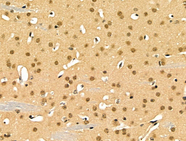 EZH1 Antibody in Immunohistochemistry (Paraffin) (IHC (P))