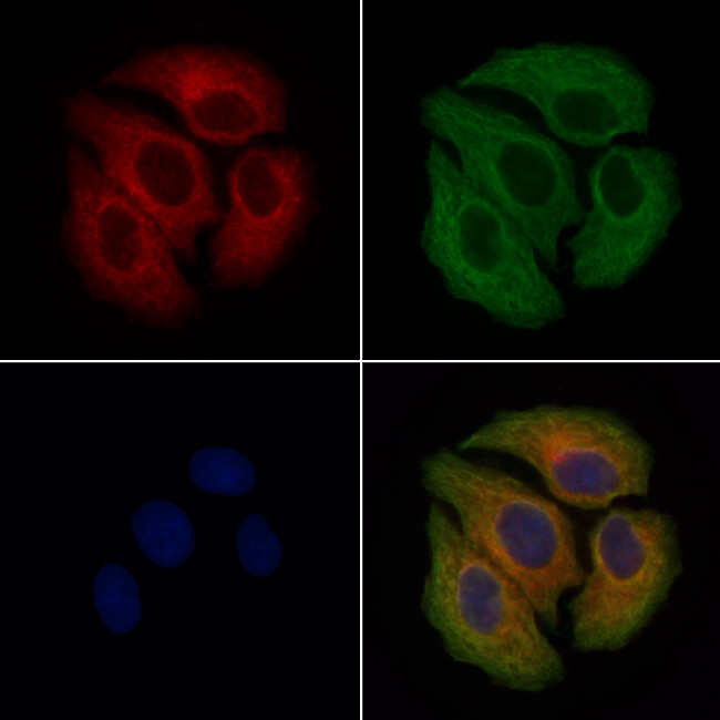 Factor VII Antibody in Immunocytochemistry (ICC/IF)