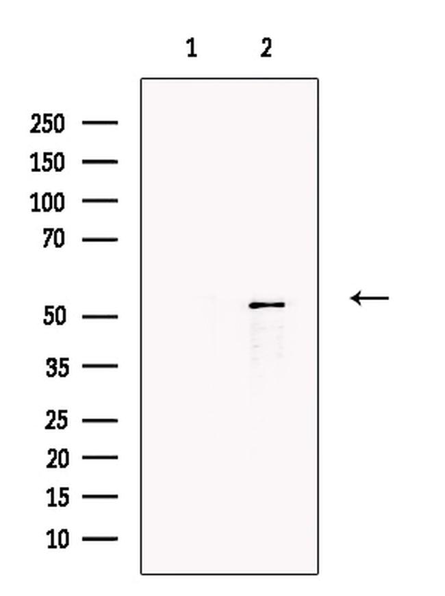 Factor VII Antibody in Western Blot (WB)