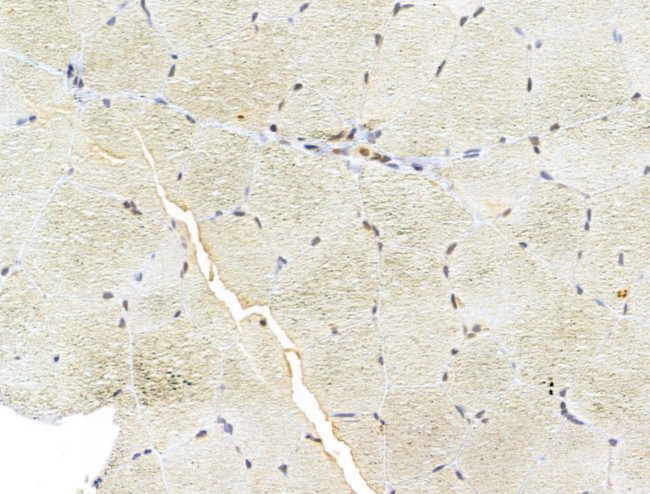 FARSB Antibody in Immunohistochemistry (Paraffin) (IHC (P))