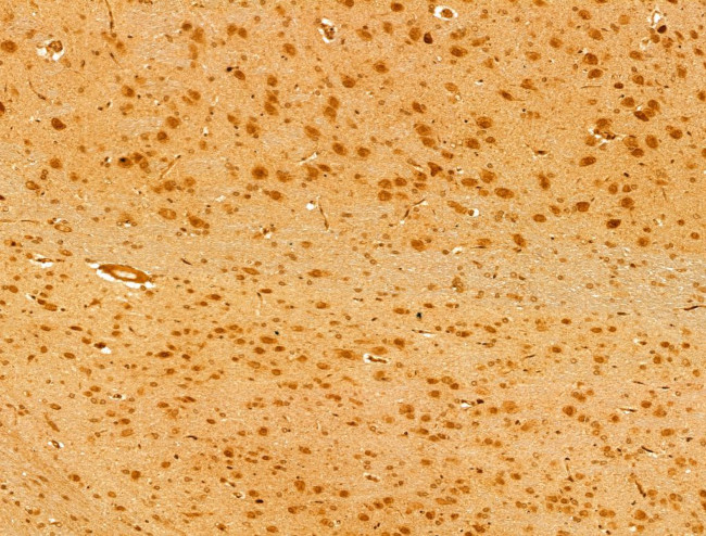 FARSB Antibody in Immunohistochemistry (Paraffin) (IHC (P))