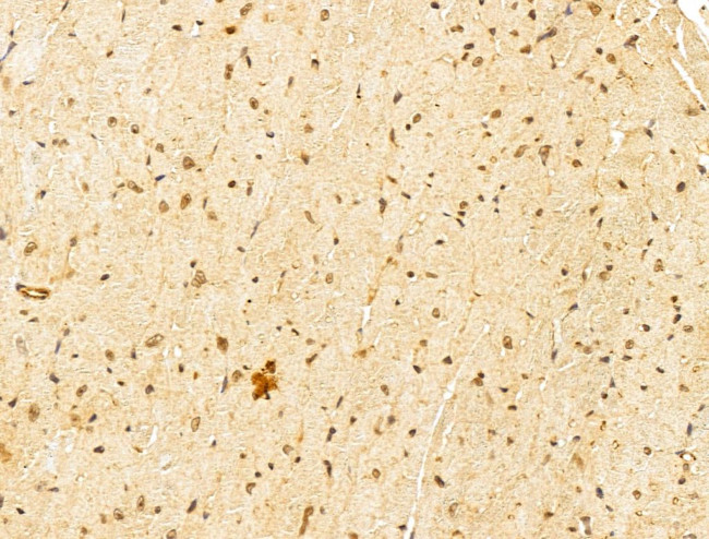 FARSB Antibody in Immunohistochemistry (Paraffin) (IHC (P))