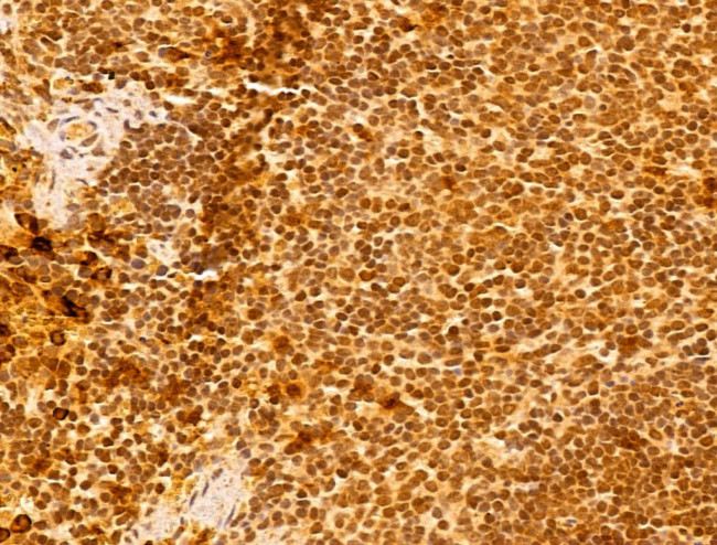 FARSB Antibody in Immunohistochemistry (Paraffin) (IHC (P))