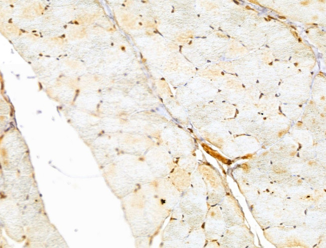 FARSB Antibody in Immunohistochemistry (Paraffin) (IHC (P))