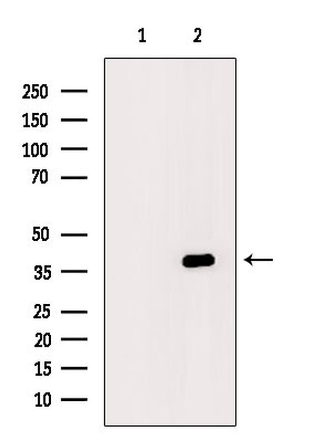 FAS (CD95) Antibody in Western Blot (WB)