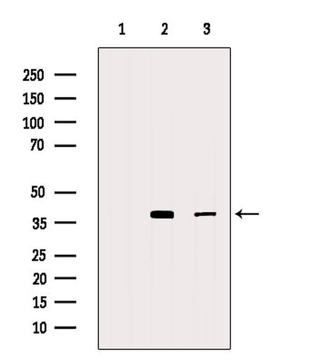 FAS (CD95) Antibody in Western Blot (WB)