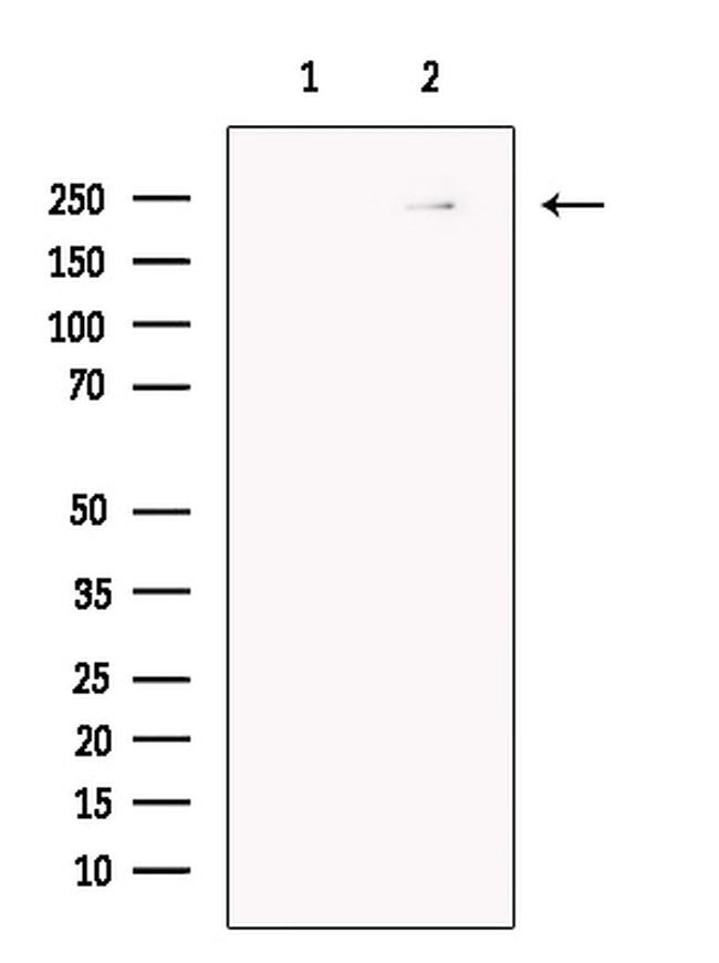 Myosin Heavy Chain Antibody in Western Blot (WB)