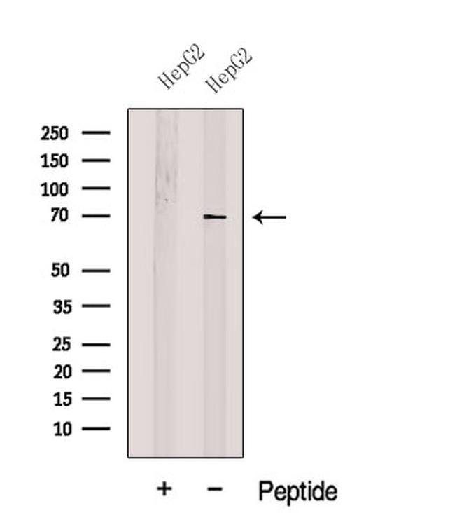 SLC27A4 Antibody in Western Blot (WB)