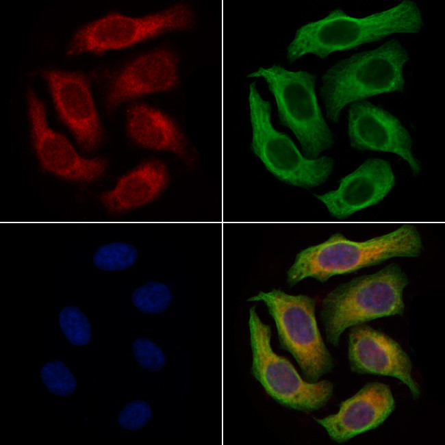 FDXR Antibody in Immunocytochemistry (ICC/IF)