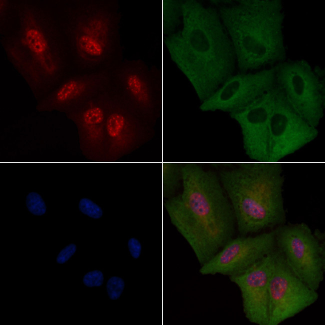 FGF1 Antibody in Immunocytochemistry (ICC/IF)