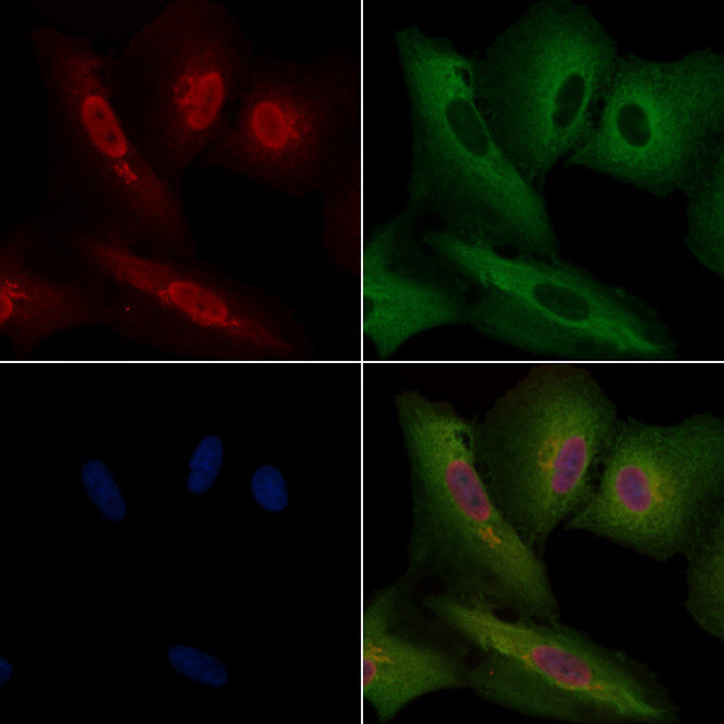 FGF2 Antibody in Immunocytochemistry (ICC/IF)