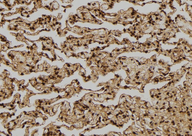 FGF2 Antibody in Immunohistochemistry (Paraffin) (IHC (P))