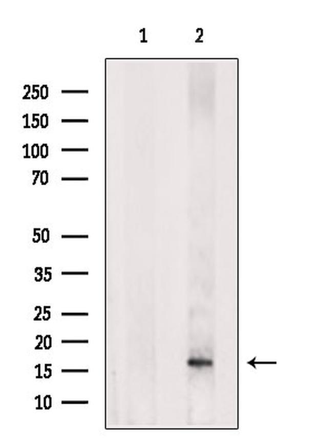 FGF21 Antibody in Western Blot (WB)