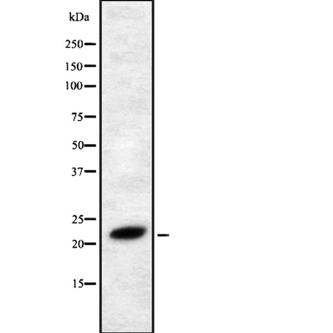 FGF4 Antibody in Western Blot (WB)