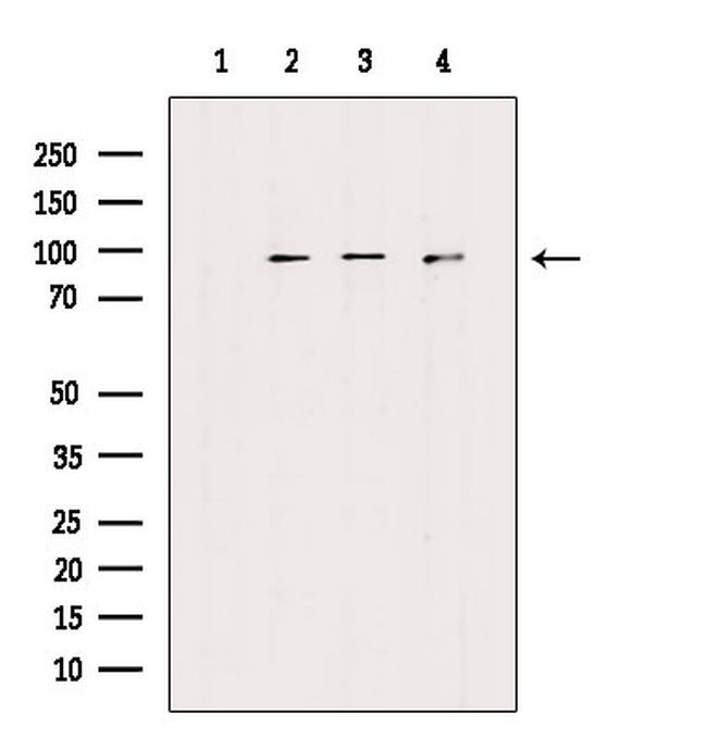 FGFR1/FGFR2 Antibody in Western Blot (WB)