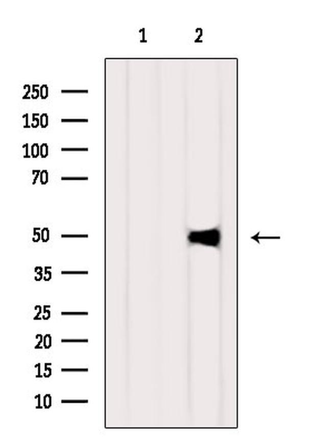 FGL2 Antibody in Western Blot (WB)