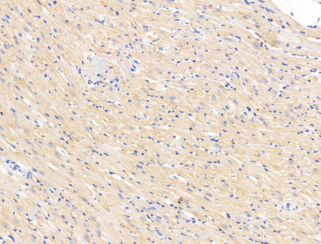 FKBP3 Antibody in Immunohistochemistry (Paraffin) (IHC (P))