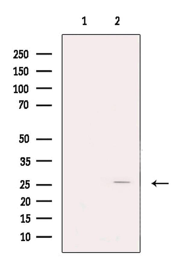 FKBP3 Antibody in Western Blot (WB)