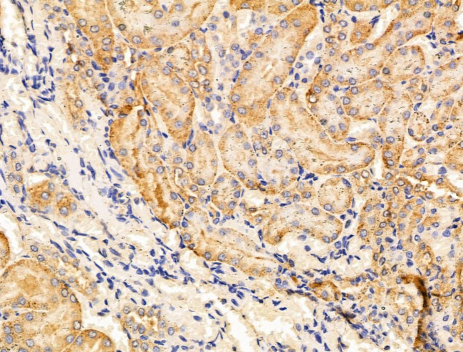 SEM1 isoform 2 Antibody in Immunohistochemistry (Paraffin) (IHC (P))