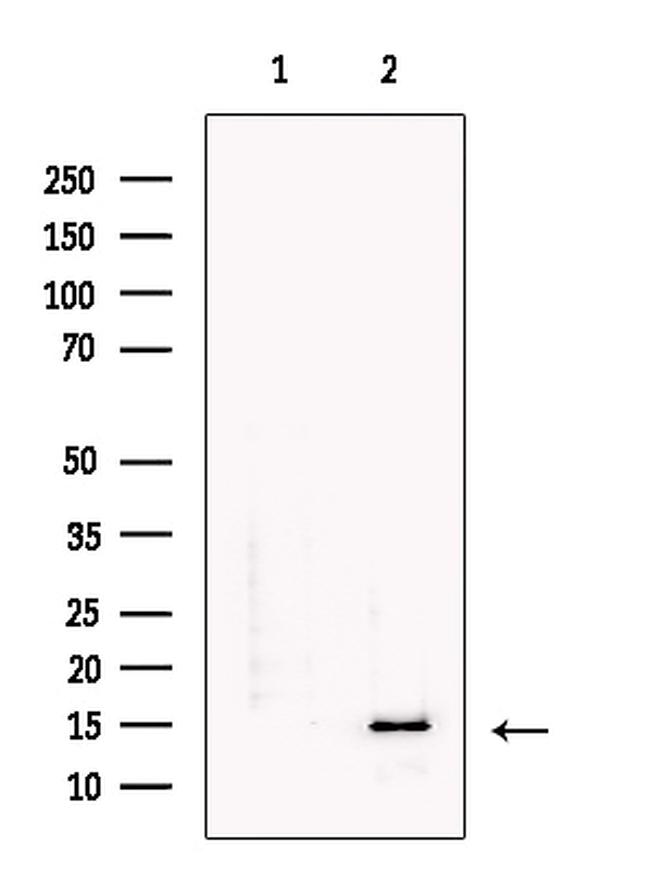 SEM1 isoform 2 Antibody in Western Blot (WB)