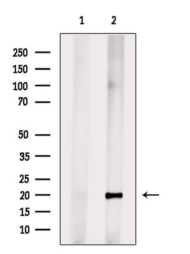 SEM1 isoform 2 Antibody in Western Blot (WB)