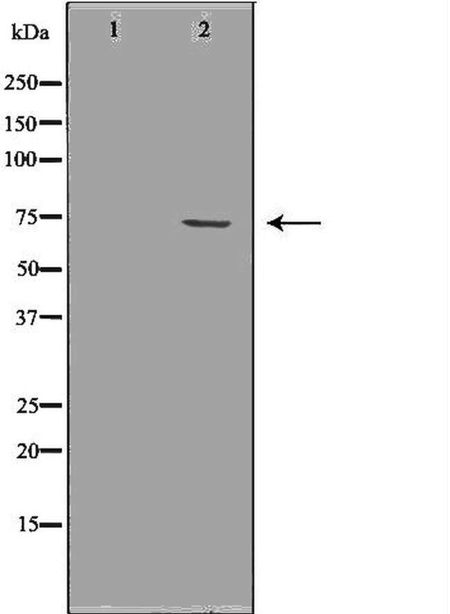 FMRP Antibody in Western Blot (WB)