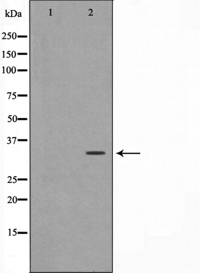 FosB Antibody in Western Blot (WB)