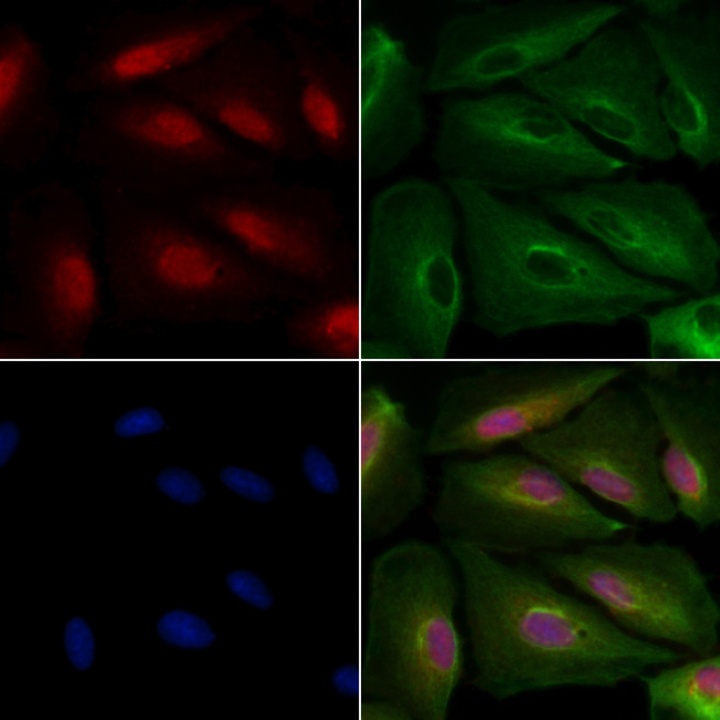 FOXA1 Antibody in Immunocytochemistry (ICC/IF)