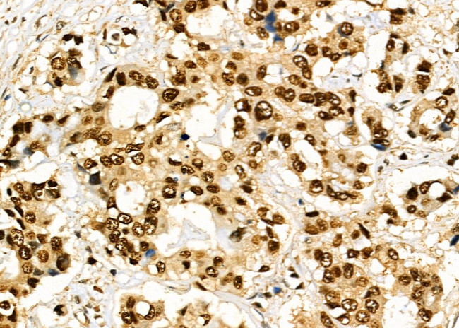 FOXA1 Antibody in Immunohistochemistry (Paraffin) (IHC (P))