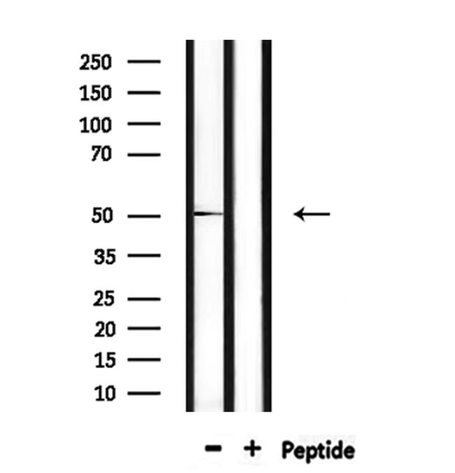 FOXA1 Antibody in Western Blot (WB)