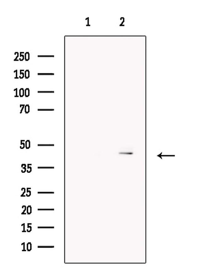 FOXF1 Antibody in Western Blot (WB)