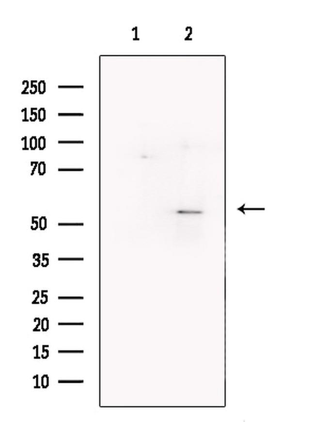 FOXG1 Antibody in Western Blot (WB)