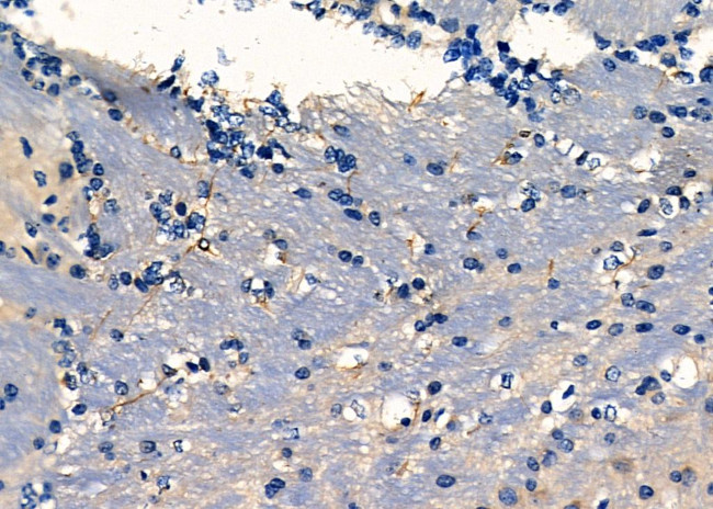 Fascin Antibody in Immunohistochemistry (Paraffin) (IHC (P))