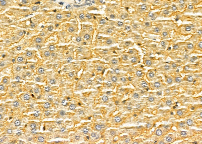 FZD1 Antibody in Immunohistochemistry (Paraffin) (IHC (P))