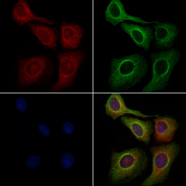 GABRB3 Antibody in Immunocytochemistry (ICC/IF)