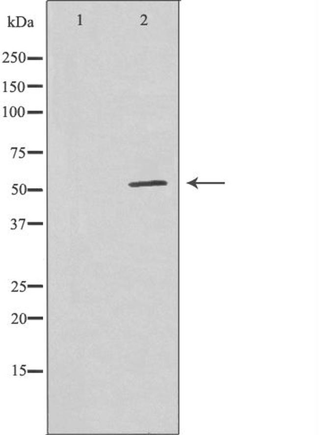 GABRG1 Antibody in Western Blot (WB)