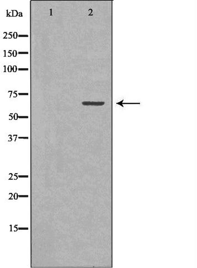 GAD65 Antibody in Western Blot (WB)