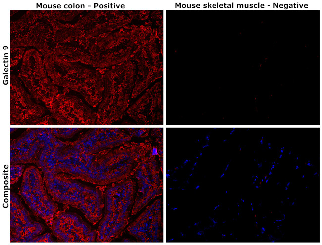 Galectin 9 Antibody in Immunohistochemistry (Paraffin) (IHC (P))