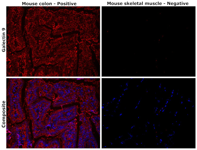 Galectin 9 Antibody in Immunohistochemistry (Paraffin) (IHC (P))