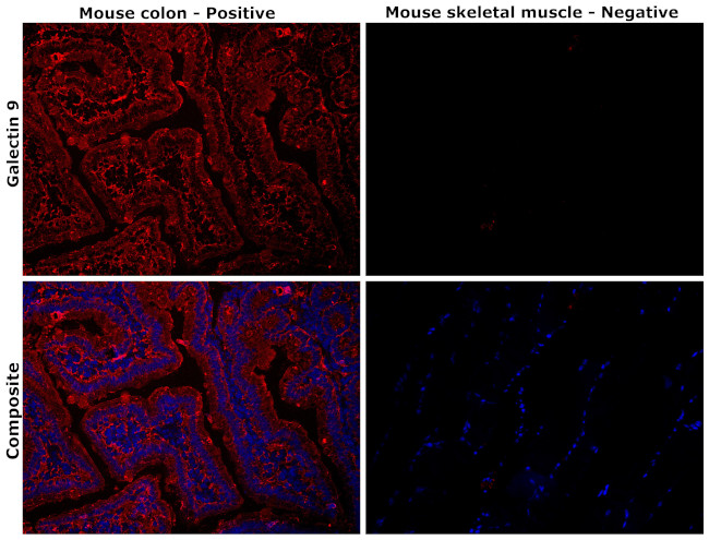 Galectin 9 Antibody in Immunohistochemistry (Paraffin) (IHC (P))