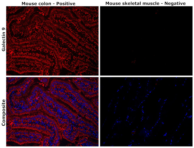 Galectin 9 Antibody